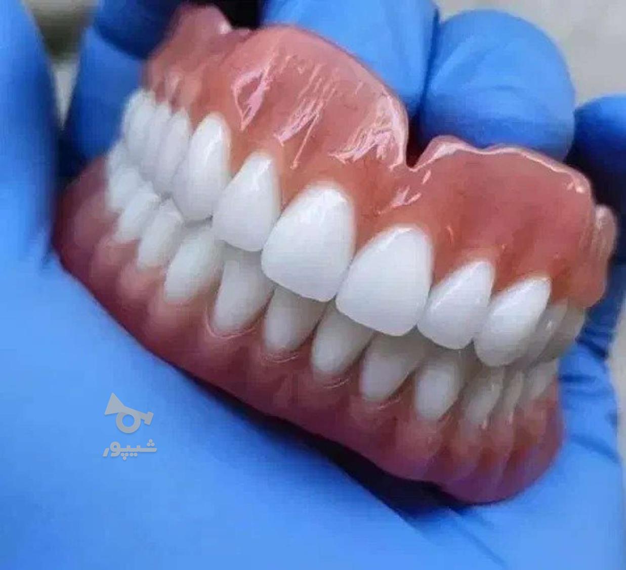 دندانپزشکی اقساطی بدون پیش پرداخت