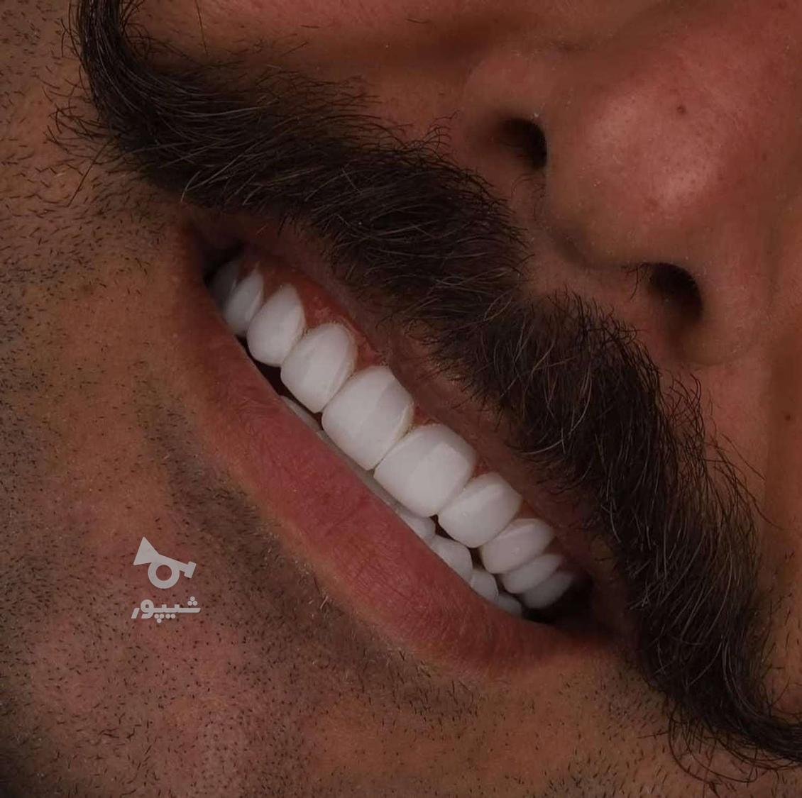 دندانپزشکی اقساطی بدون پیش پرداخت