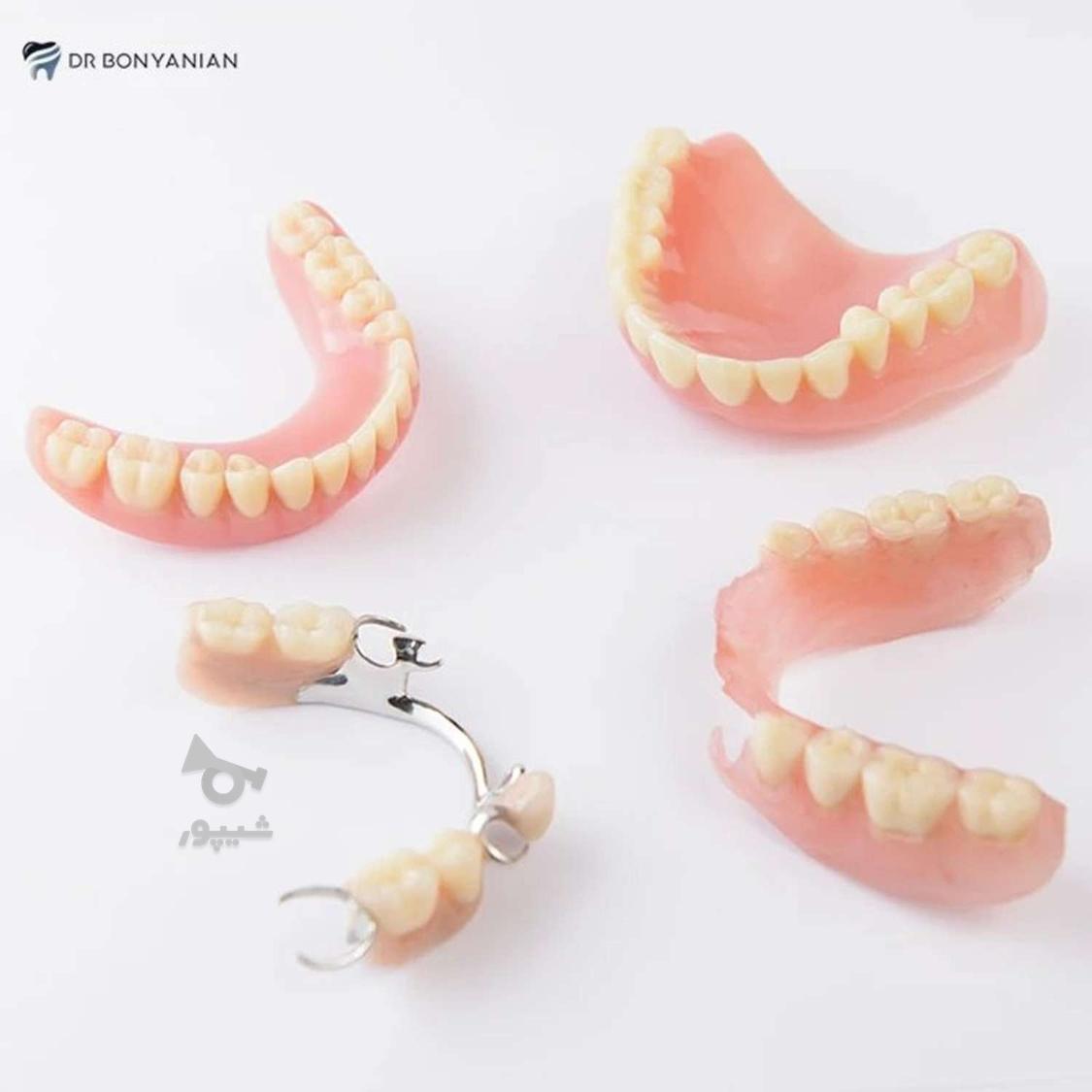 ارائه کلیه خدمات دندانپزشکی با کمترین قیمت (دولتی)