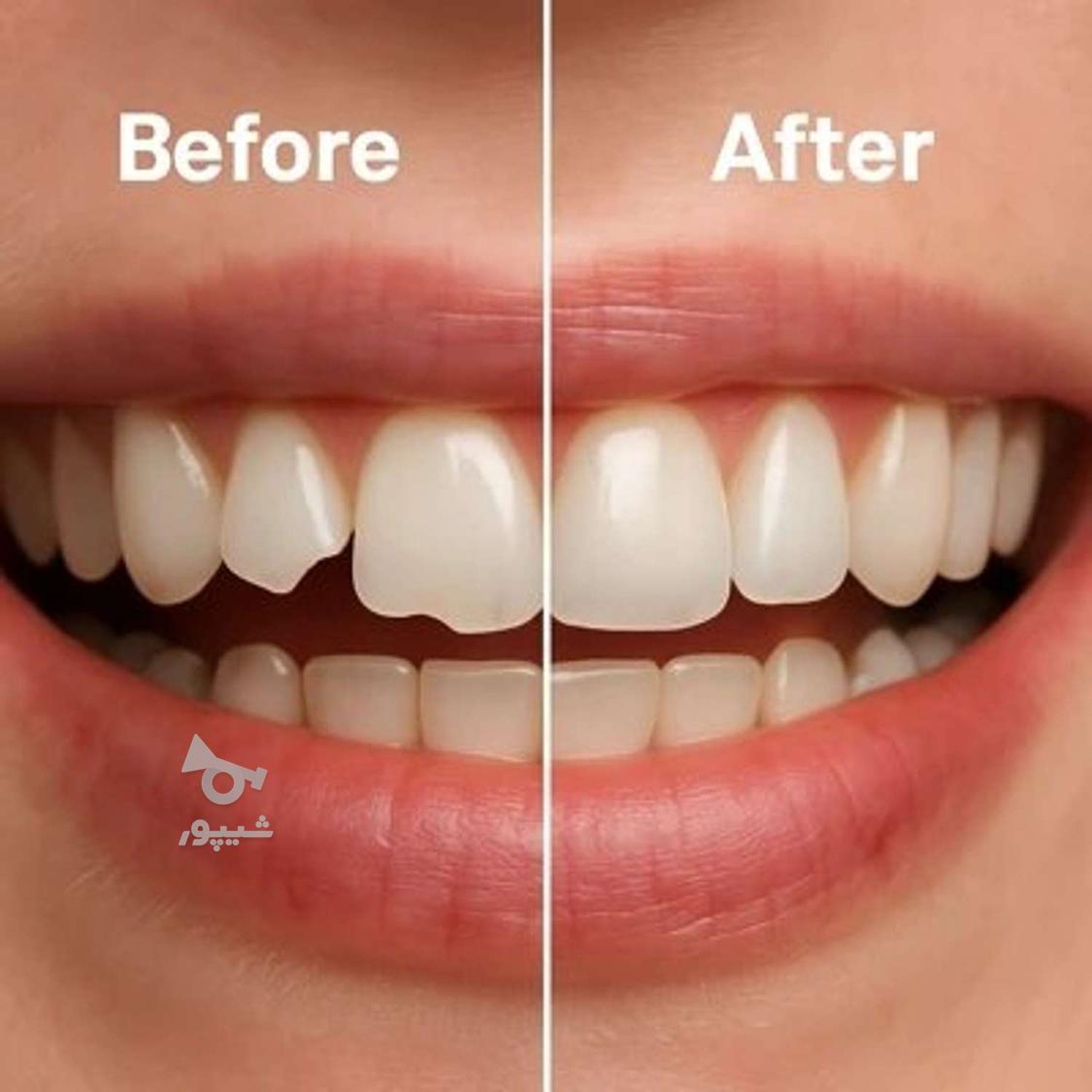 ارائه کلیه خدمات دندانپزشکی با کمترین قیمت (دولتی)