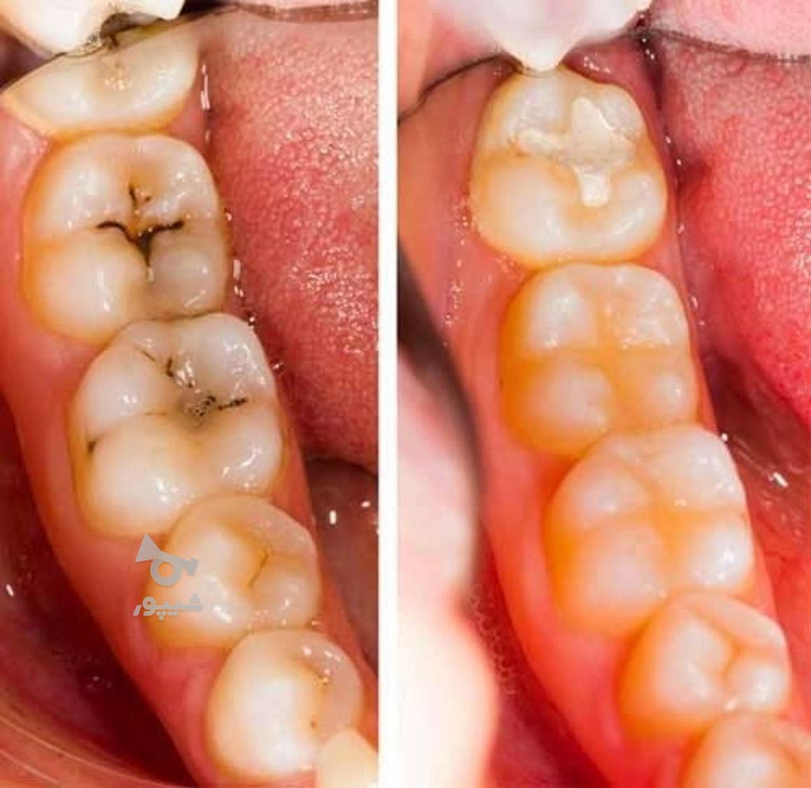 ارائه کلیه خدمات دندانپزشکی با کمترین قیمت (دولتی)