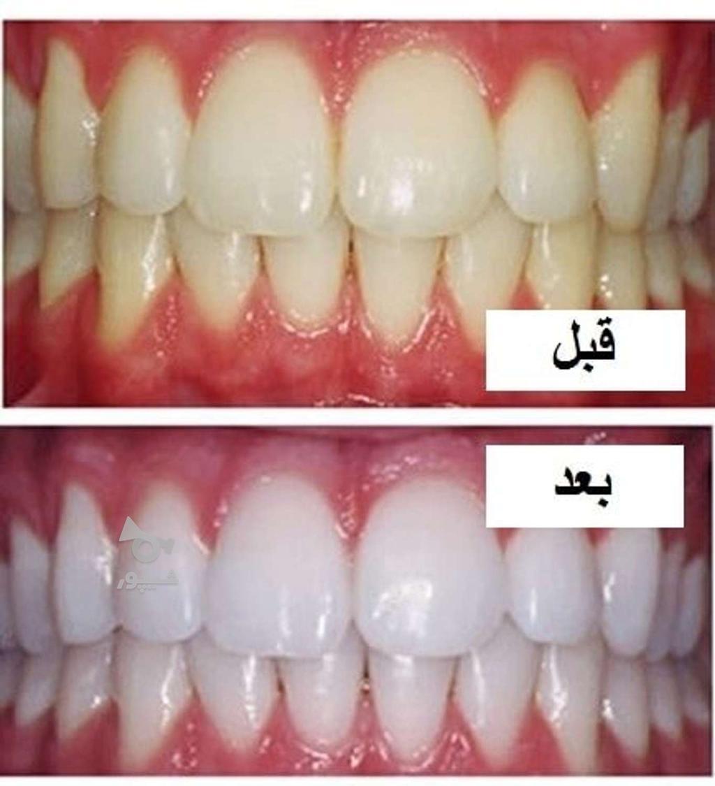 ارائه کلیه خدمات دندانپزشکی با کمترین قیمت (دولتی)