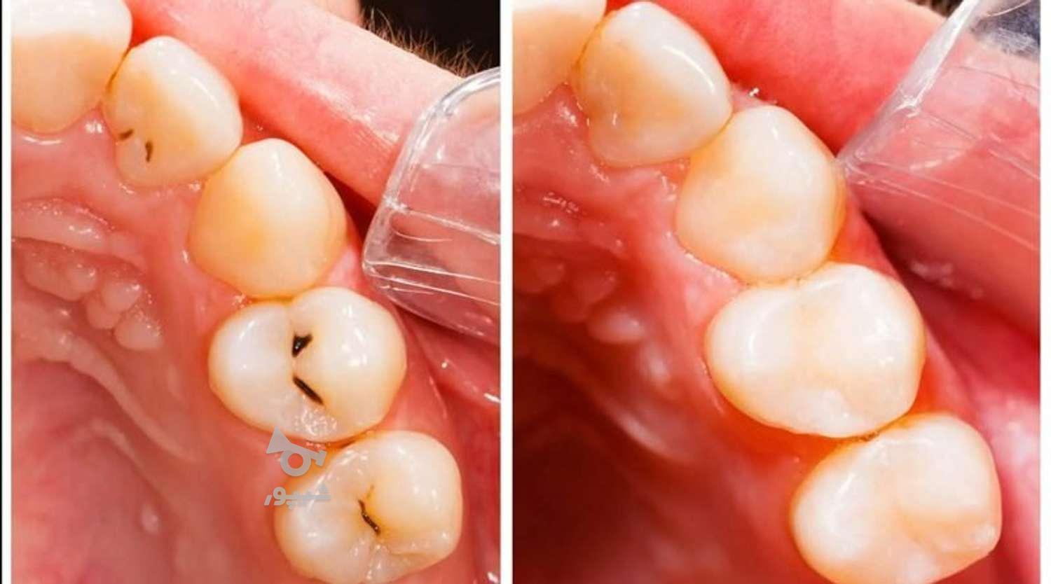 ارائه کلیه خدمات دندانپزشکی با کمترین قیمت (دولتی)