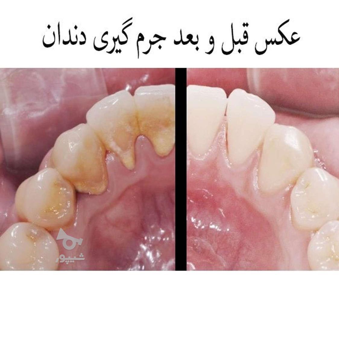 ارائه کلیه خدمات دندانپزشکی با کمترین قیمت (دولتی)