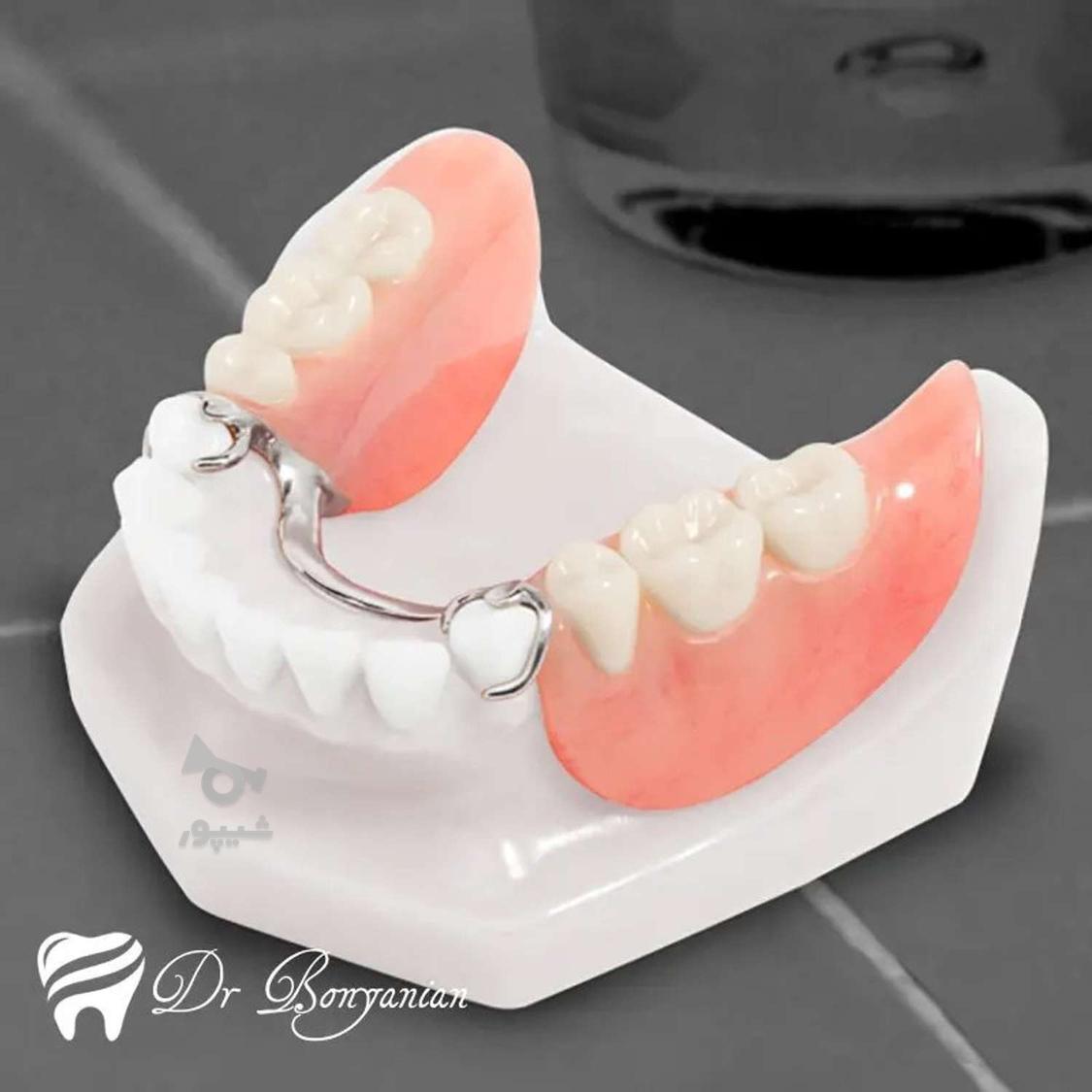 ارائه کلیه خدمات دندانپزشکی با کمترین قیمت (دولتی)