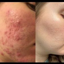 کرم شب صدف هم ضد لک هم ضد جوش هم سفید کننده