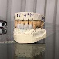 دندانپزشکی دندانسازی