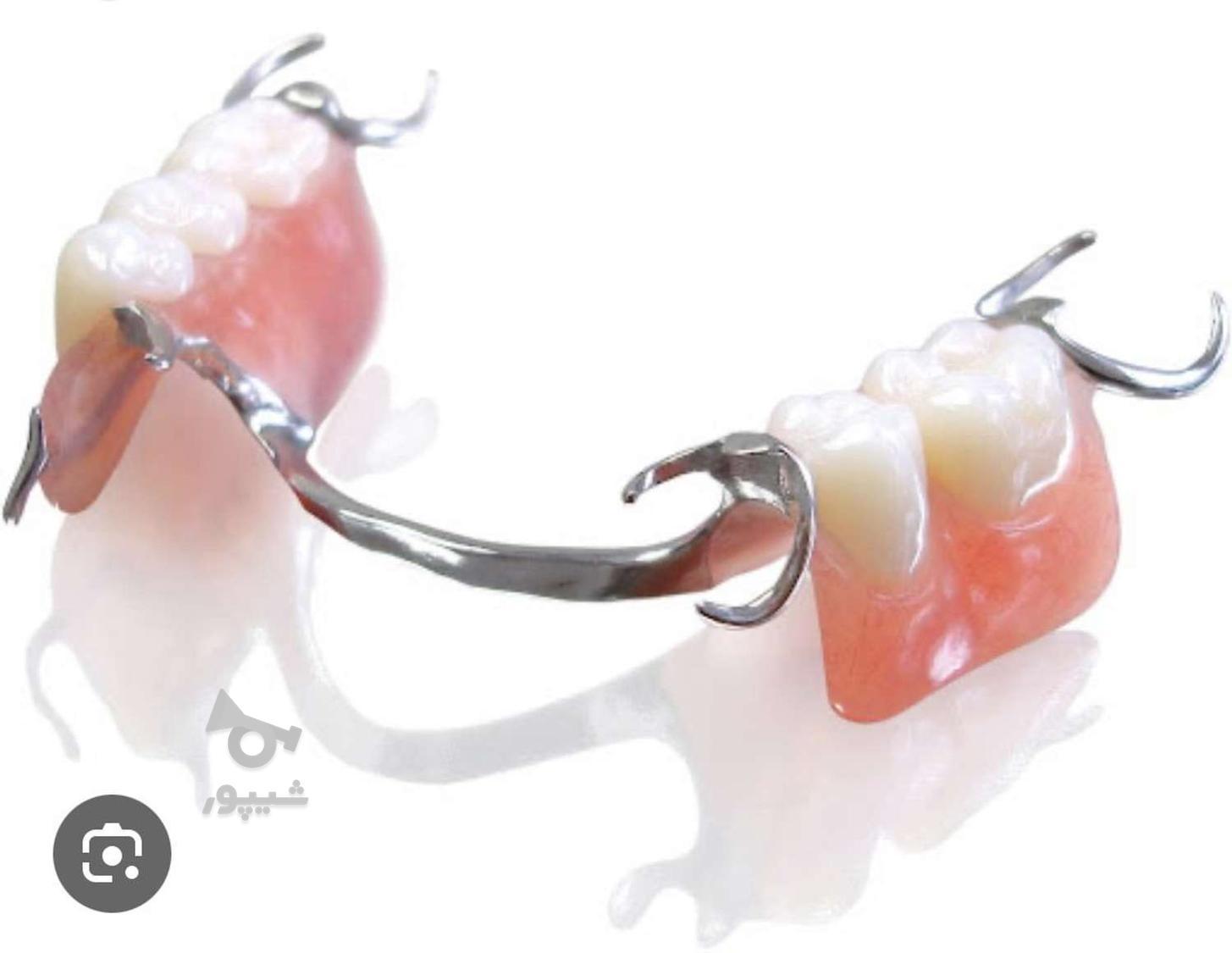 ساخت دندان مصنوعی
