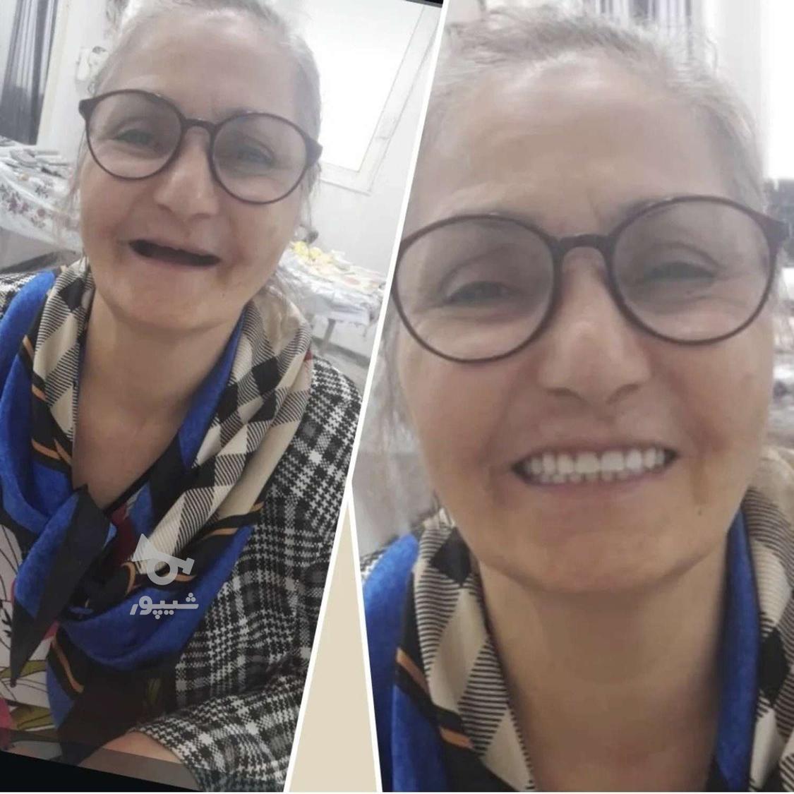 ساخت دندان مصنوعی