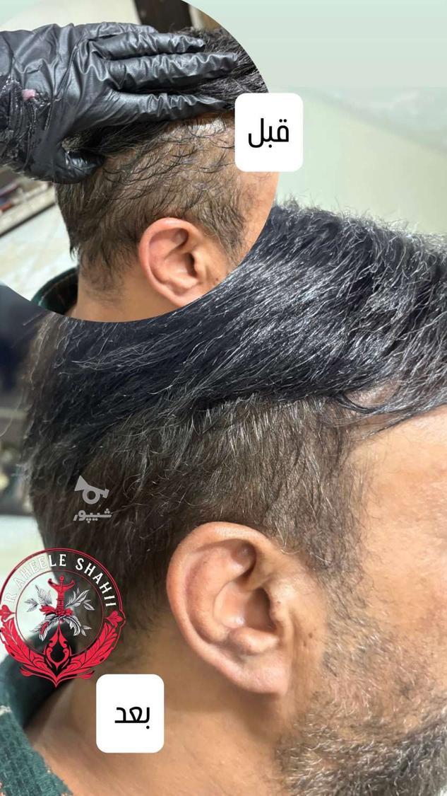 تتو بدن، میکروبلیدینگ، اسکالپ سر، شیدینگ لب و پرسینگ