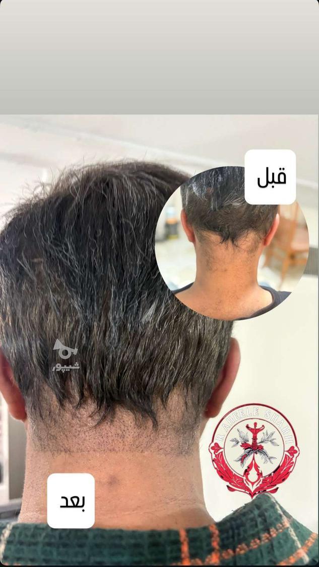 تتو بدن، میکروبلیدینگ، اسکالپ سر، شیدینگ لب و پرسینگ