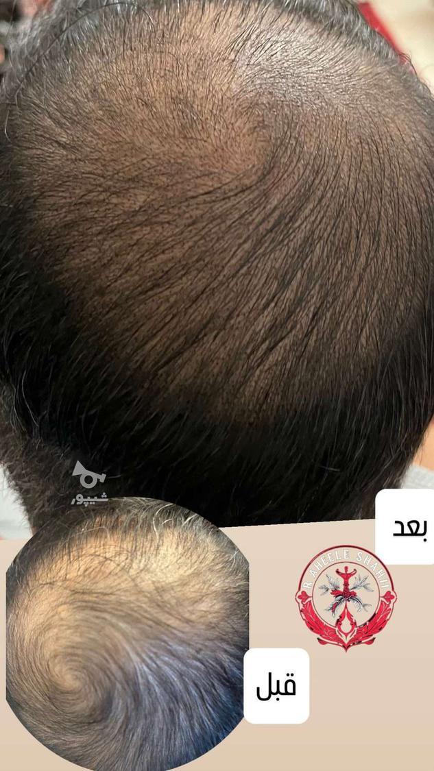 تتو بدن، میکروبلیدینگ، اسکالپ سر، شیدینگ لب و پرسینگ