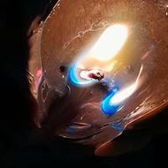 شمع تراپی انجام می شود