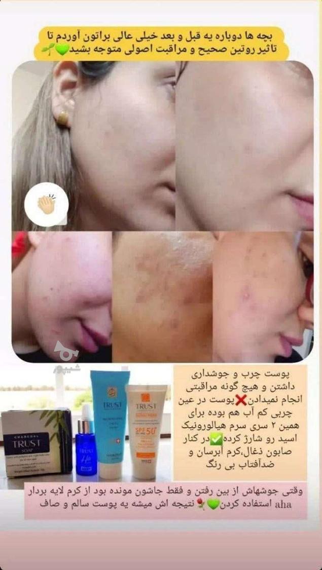 لیفت وجوانسازی پوست