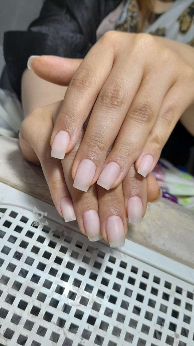 ترمیم ناخن و کاشت