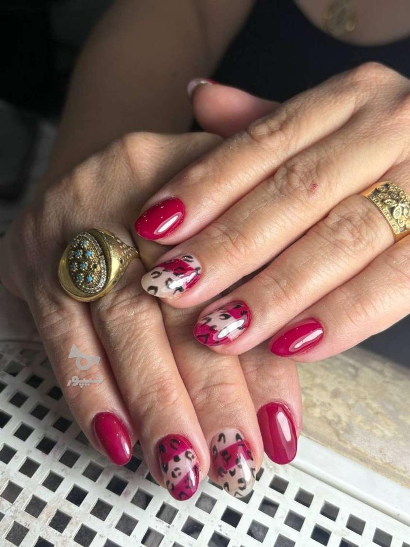 ترمیم ناخن و کاشت