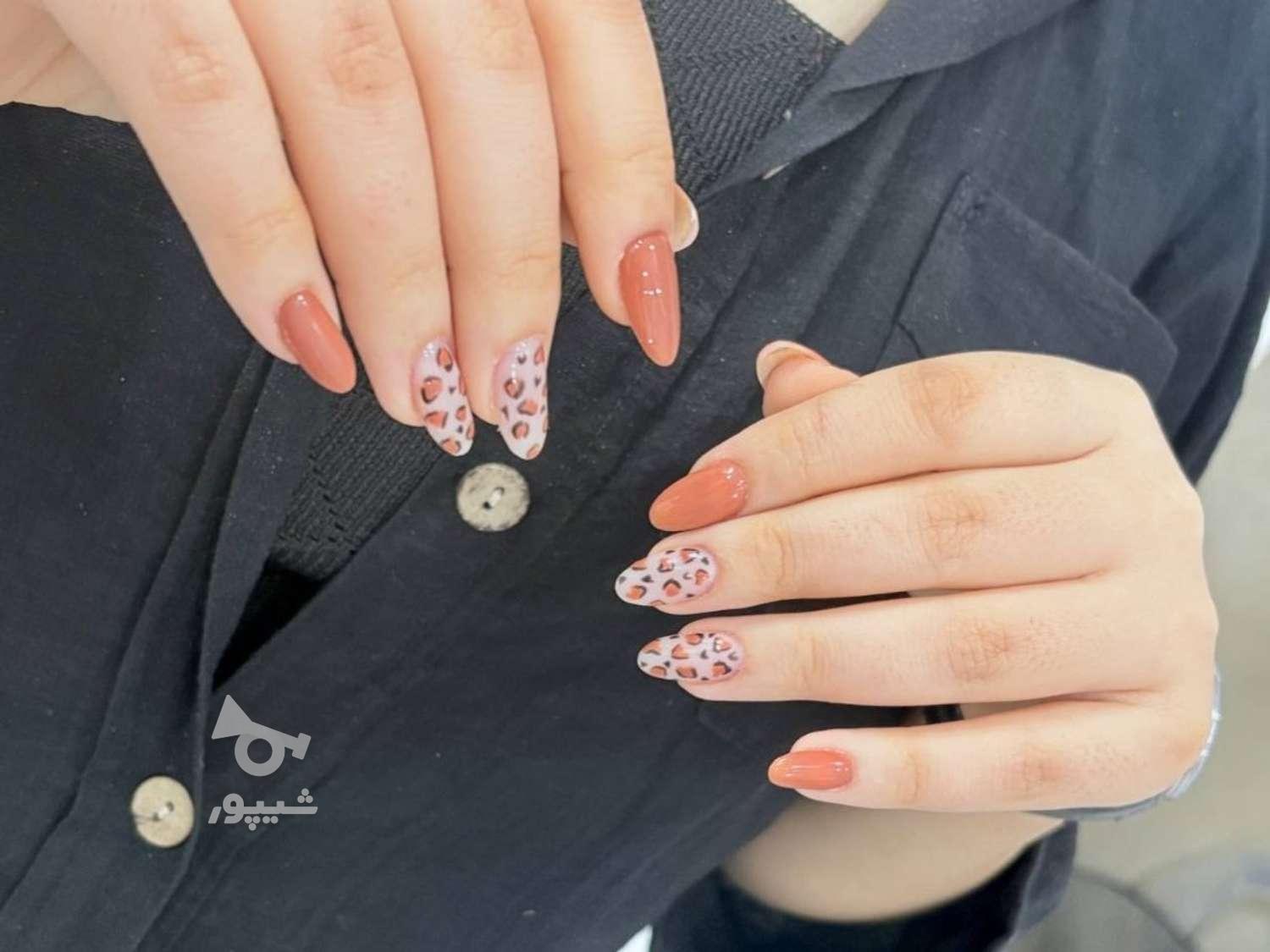 ترمیم ناخن و کاشت