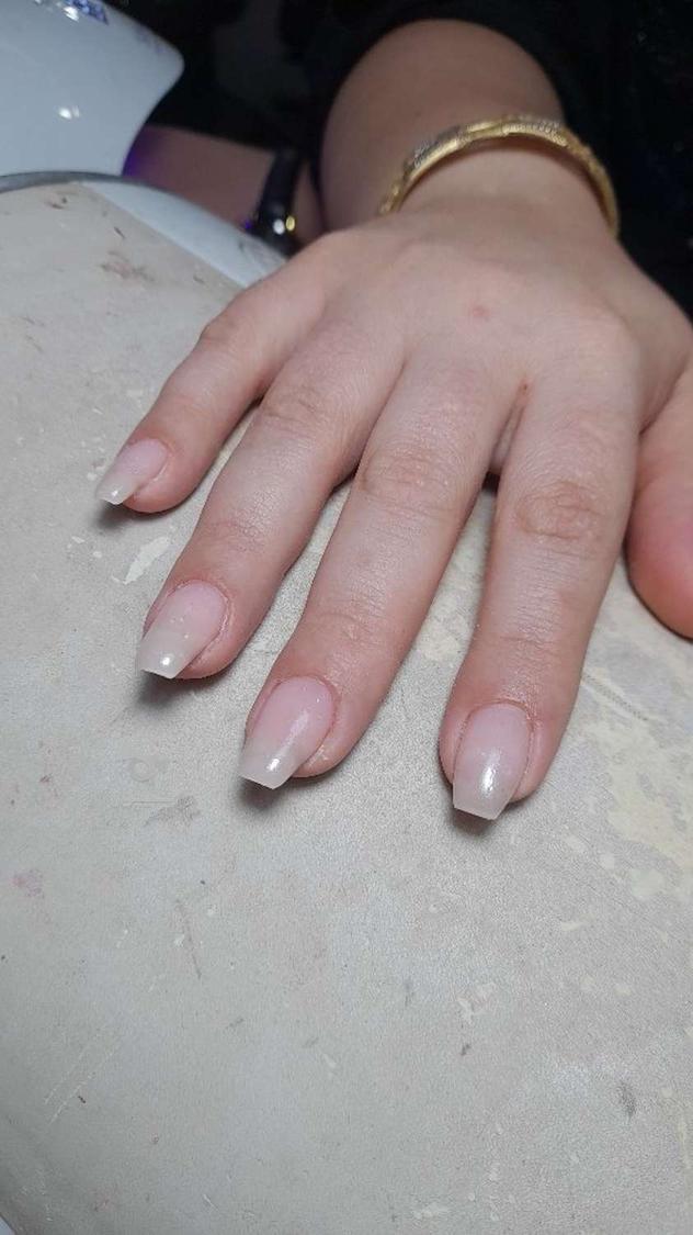 ترمیم ناخن و کاشت