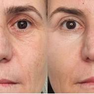 لوازم آرایشی ومراقبتی لدورا همراه با مشاوره