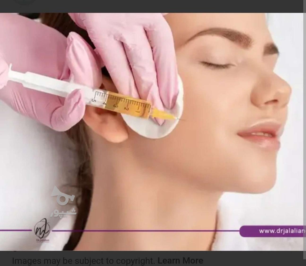 پی آر پی سر و صورت