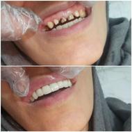 آموزش دندانپزشکی و دندان سازی