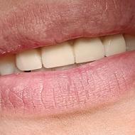 استخدام دستیار دندانپزشک خانم