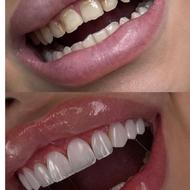 ساخت انواع دست دندان و روکش مستقیم از لابراتوار