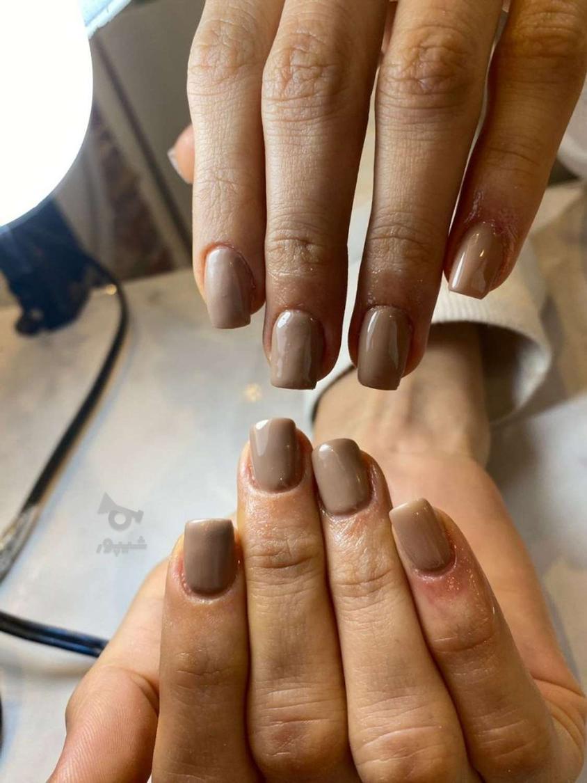 کاشت و ترمیم رایگان ناخن