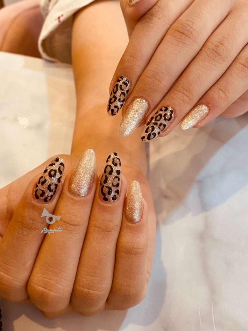 کاشت و ترمیم رایگان ناخن