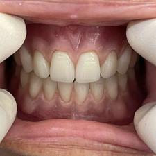 کلینیک پروتز دندان سیب