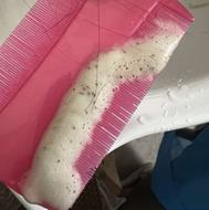 درمان ریشه ای شپش رشک