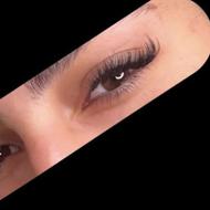 کاشت مژه کلاسیک