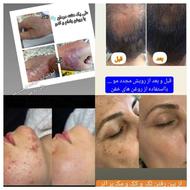 پوست ومو زیبایی فقط باروغن های 100درصدگیاهی