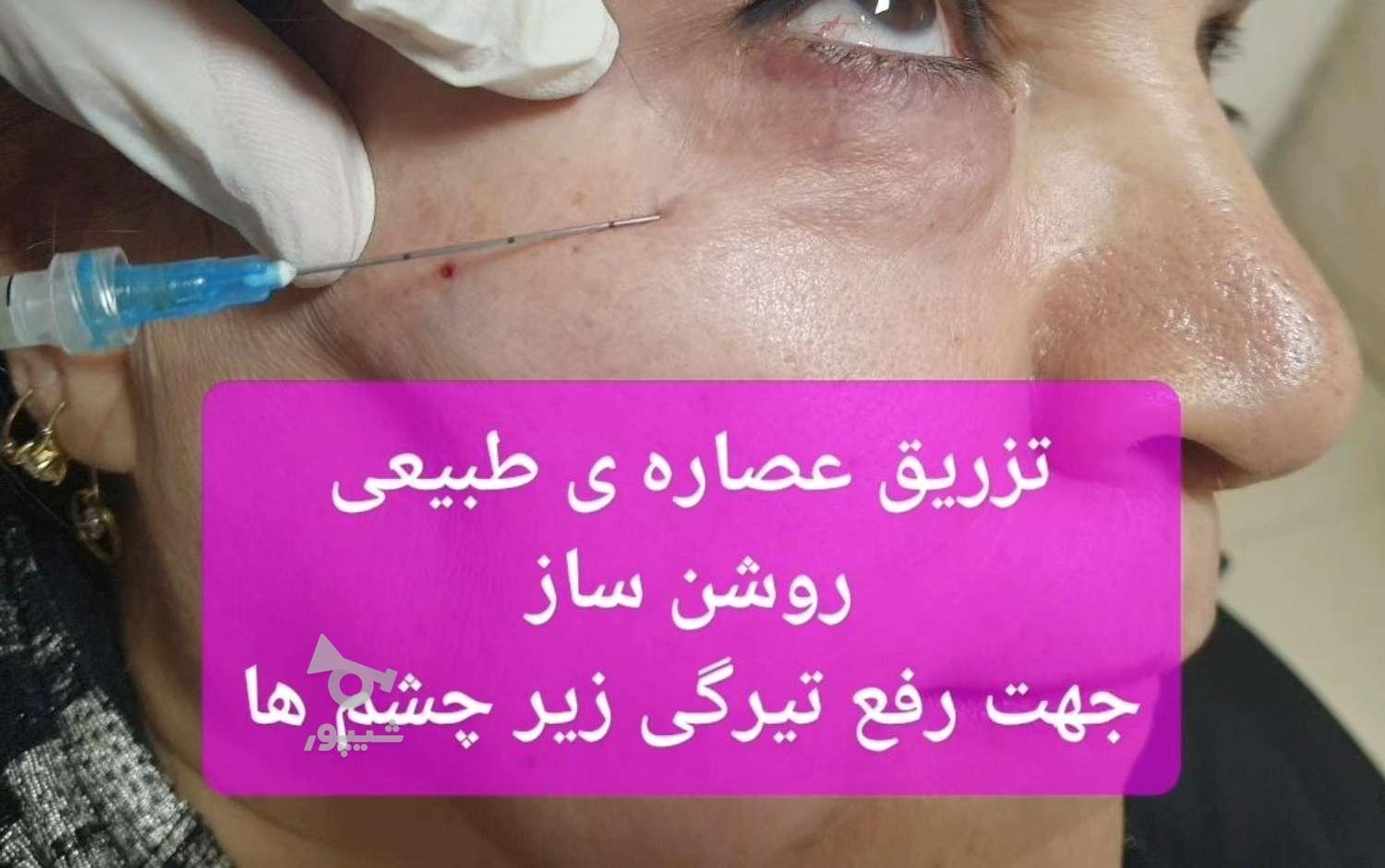 بوتاکس و جوانسازی کامل پوست