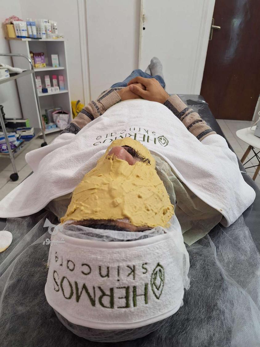 فیشال و پاکسازی صورت