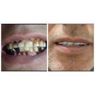 اورژانس دندانپزشکی در محل(منزل شما)