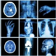 خرید طلق و عکس رادیولوژی