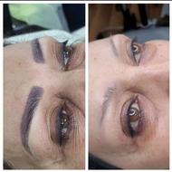 ریموو تخصصی تتوی بدرنگ( تک جلسه،تضمینی)فیبروز، شید لب و...