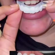 لمینت دندان اصل.لمینت متحرک.کامپوزیت.دندان مصنوعی.لمینت فوری