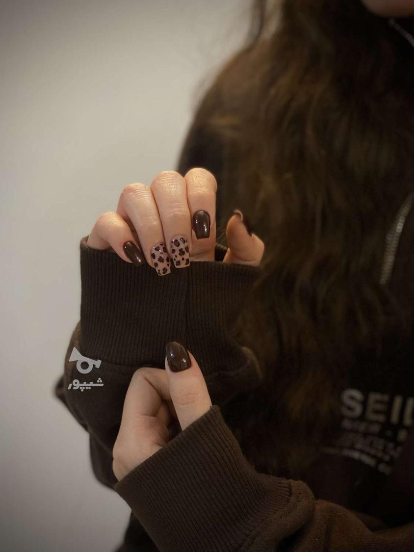 خدمات کاشت ترمیم ناخن