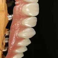 فرصتی عالی برای علاقمندان به حرفه دندانسازی