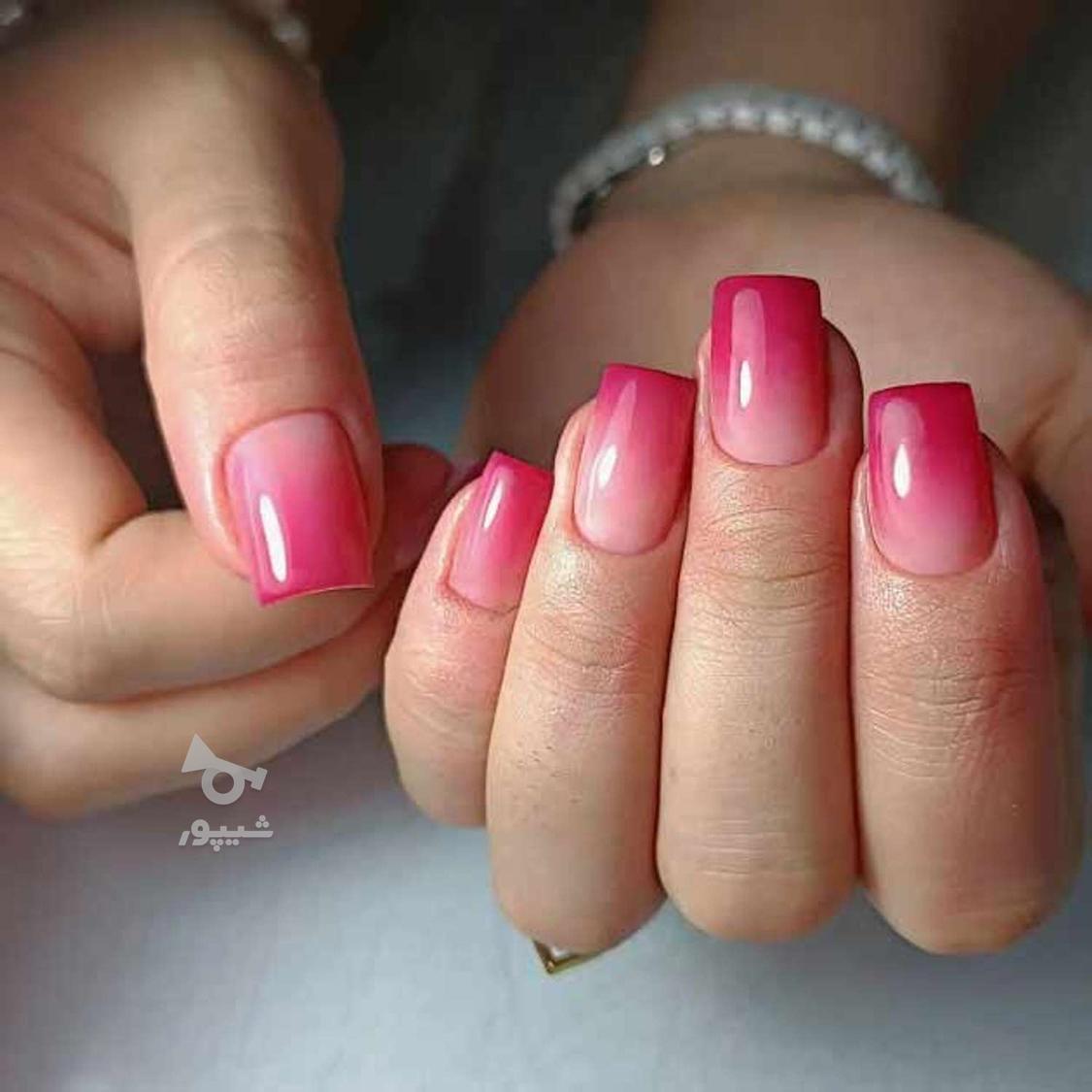 کاشت وترمیم وژلیش