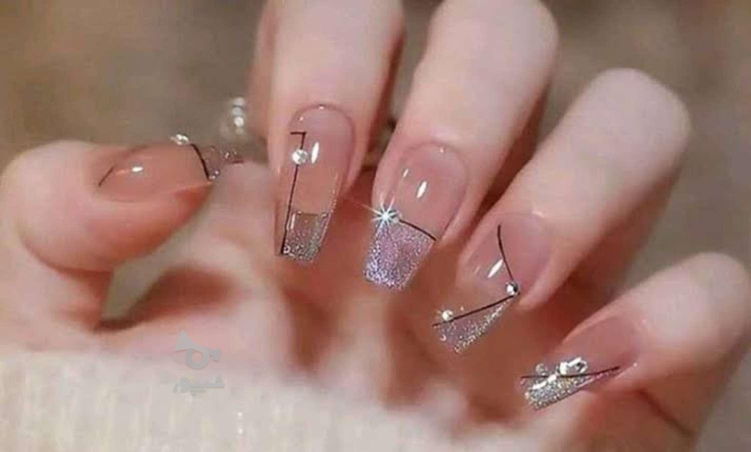 کاشت وترمیم وژلیش