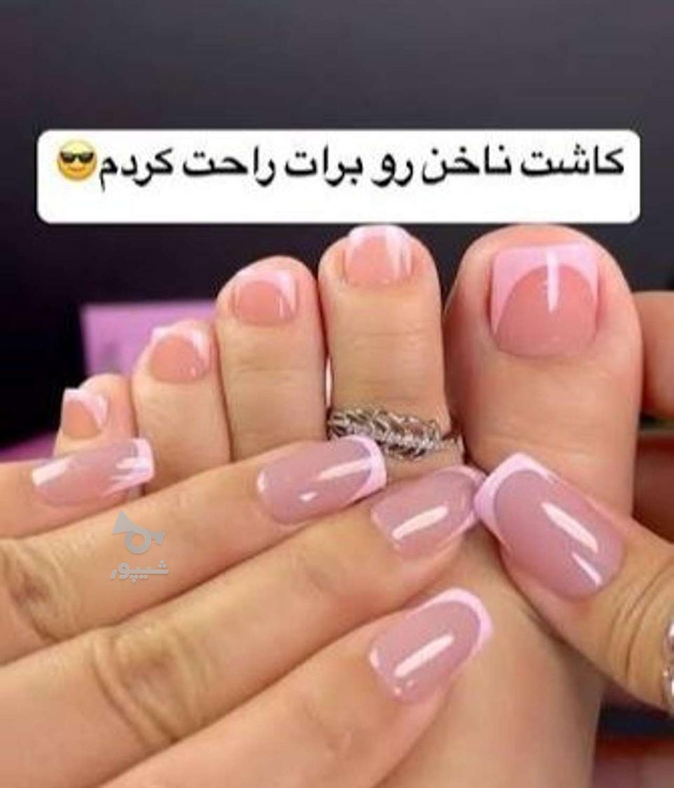 کاشت وترمیم وژلیش