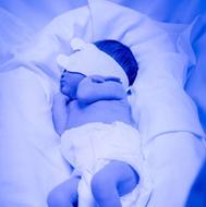 اجاره دستگاه فتوتراپی