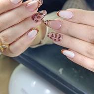 کاشت ترمیم لمینیت