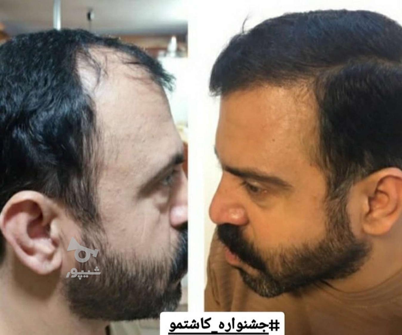 جشنواره پاییز کاشتمو(آفراقتصادی)ظرفیت8(فقط تا28ام)