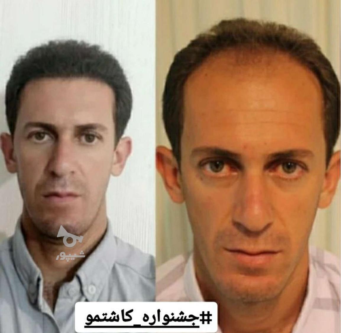 جشنواره پاییز کاشتمو(آفراقتصادی)ظرفیت8(فقط تا28ام)