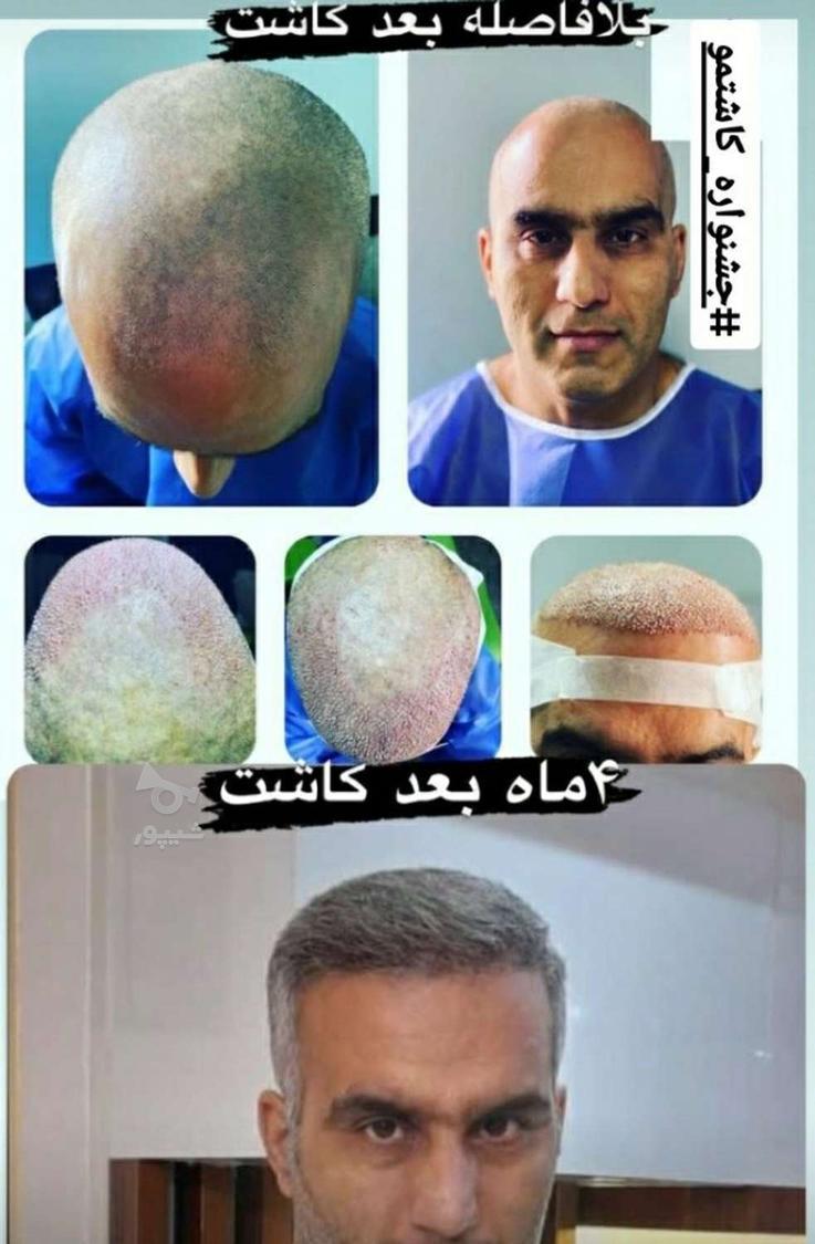 جشنواره پاییز کاشتمو(آفراقتصادی)ظرفیت8(فقط تا28ام)