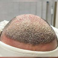 جشنواره پاییز کاشتمو(تعرفه دولتی)ظرفیت8(فقط تا28ام)